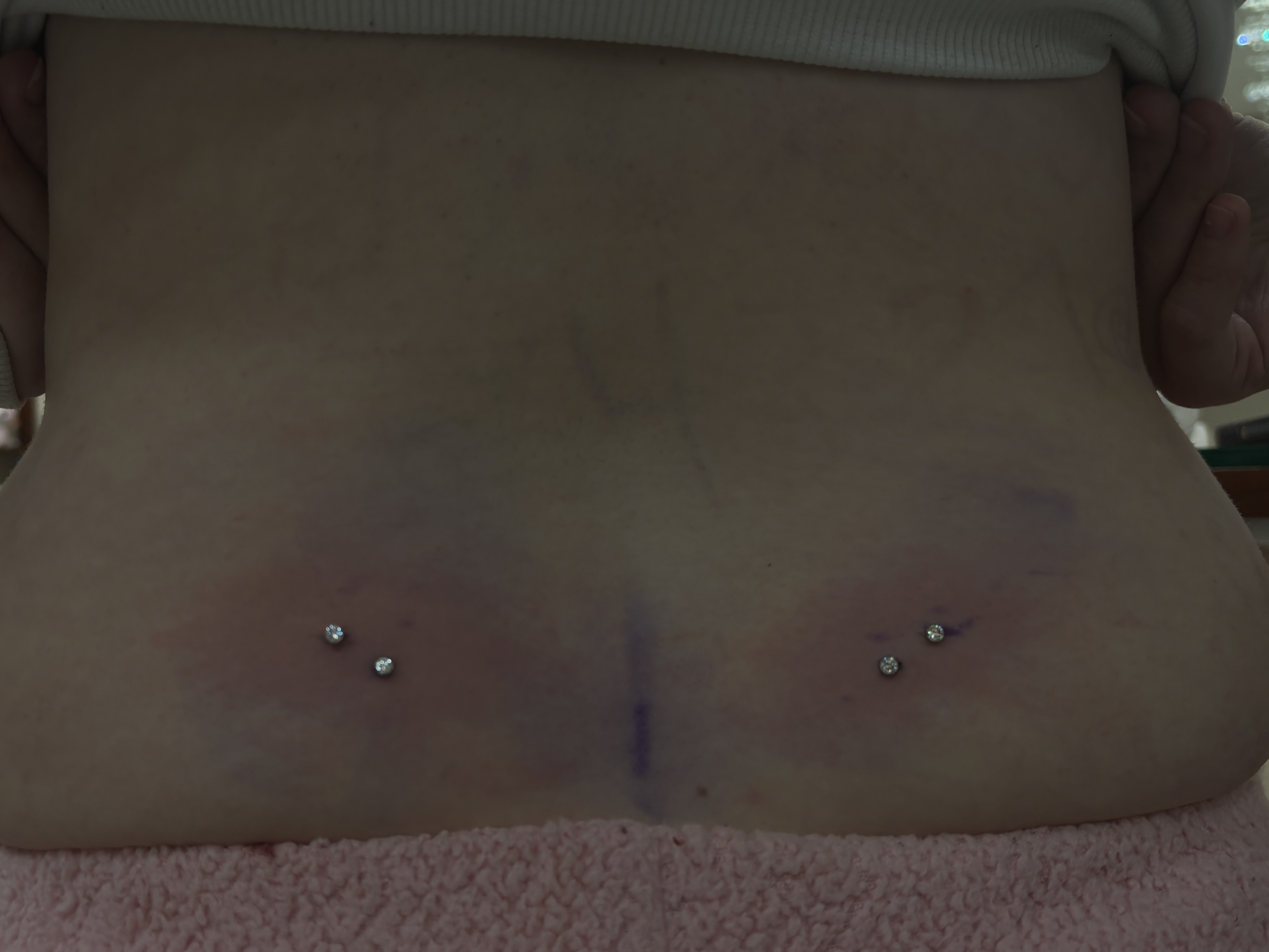 Surface body piercings with crystal ball ends